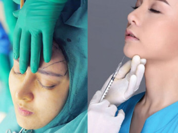 Băn khoăn giữa cấy mỡ tự thân và tiêm filler, nàng nên chọn phương pháp nào làm đẹp gương mặt?