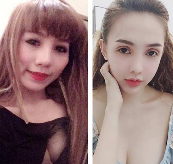 chi 400 trieu tham my thanh hotgirl, 9x sai gon gio khong dam mang bau - 1