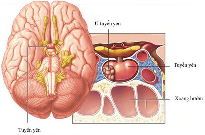 Căn bệnh khiến nam ca sĩ Wanbi Tuấn Anh qua đời cách đây 7 năm nguy hiểm thế nào? - 2