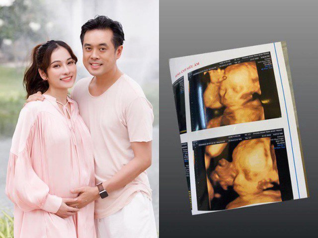 Vợ Dương Khắc Linh khoe ảnh siêu âm cặp song sinh: Mũi cao, được dự đoán là soái ca