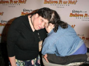 Tin tức - Cặp song sinh dính liền đầu, anh phải giả lơ khi em hôn và làm "chuyện ấy" với bạn trai