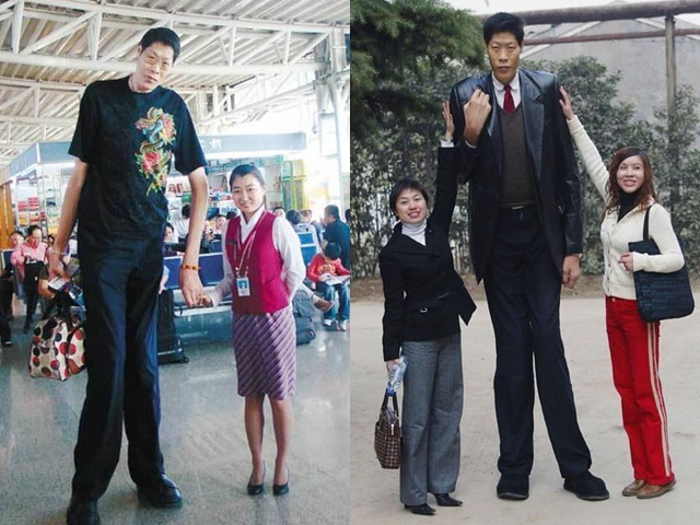 Cuộc sống của người đàn ông có đôi chân bằng chiều cao vợ, kết hôn 21 năm không có con