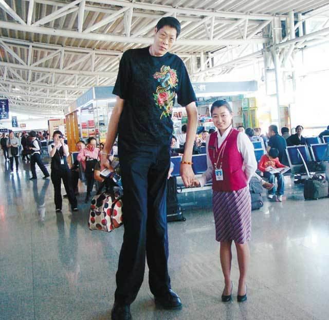 Cuộc sống của người đàn ông có đôi chân bằng chiều cao vợ, kết hôn 21 năm không có con - 3