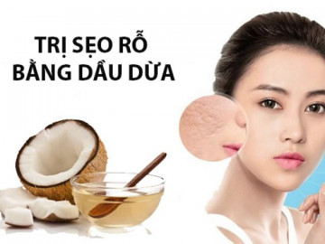 Cách trị sẹo rỗ trên mặt lâu năm tại nhà hiệu quả nhanh nhất