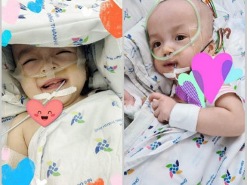 Cặp song sinh Trúc Nhi - Diệu Nhi chính thức cai máy thở, bắt đầu giỡn cười