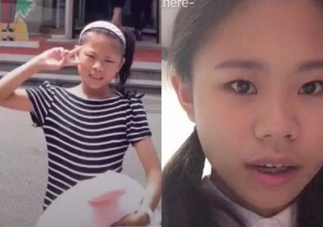 Cô gái phẫu thuật thẩm mỹ từ năm 13 tuổi, 3 năm 60 lần amp;#34;dao kéoamp;#34; giờ ra sao? - 2