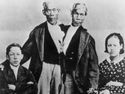 Làm mẹ - Hai ông bố lạ nhất lịch sử: Dính liền vẫn có 21 con với 2 phụ nữ chung một giường