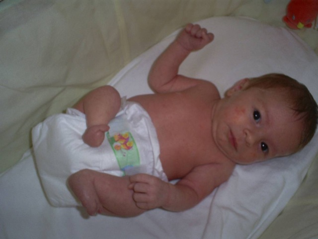 Bé gái sinh ra với chân 5cm, 18 tháng phải cắt cụt chân, sau 10 năm trở thành hiện tượng - 1