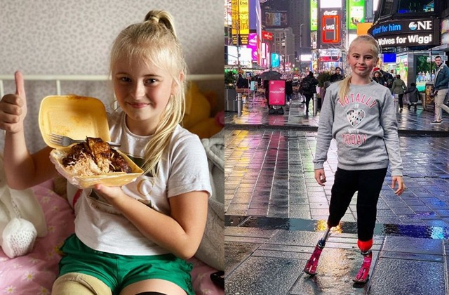 Bé gái sinh ra với chân 5cm, 18 tháng phải cắt cụt chân, sau 10 năm trở thành hiện tượng - 12