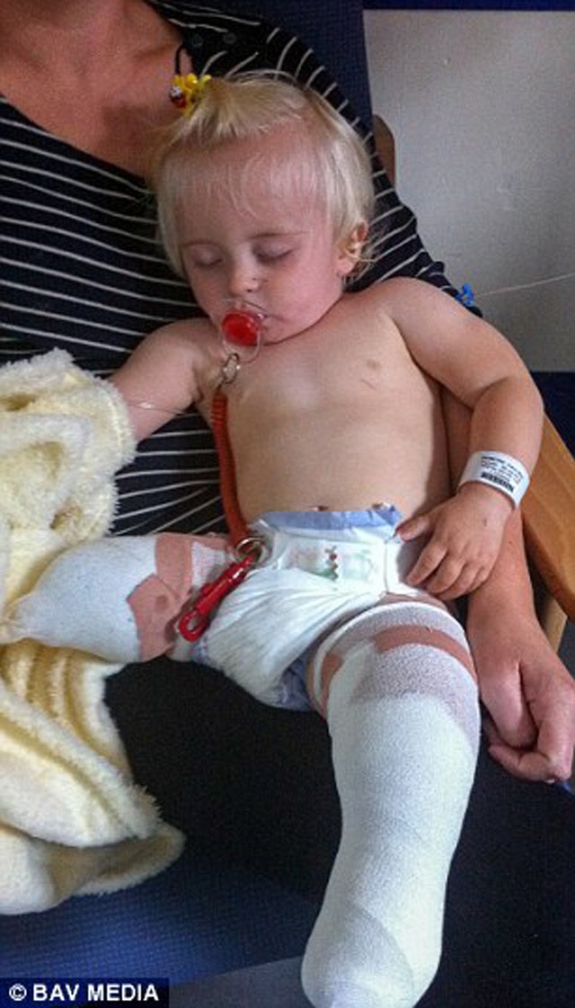 Bé gái sinh ra với chân 5cm, 18 tháng phải cắt cụt chân, sau 10 năm trở thành hiện tượng - 2