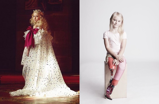 Bé gái sinh ra với chân 5cm, 18 tháng phải cắt cụt chân, sau 10 năm trở thành hiện tượng - 7