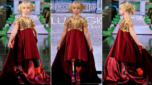 Bé gái sinh ra với chân 5cm, 18 tháng phải cắt cụt chân, sau 10 năm trở thành hiện tượng - 8