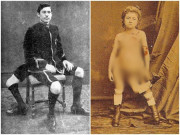 Sức khỏe - "Chuyện ấy" của người có 2 bộ phận sinh dục: Yêu nhiều người cùng lúc, ham muốn hơn người thường