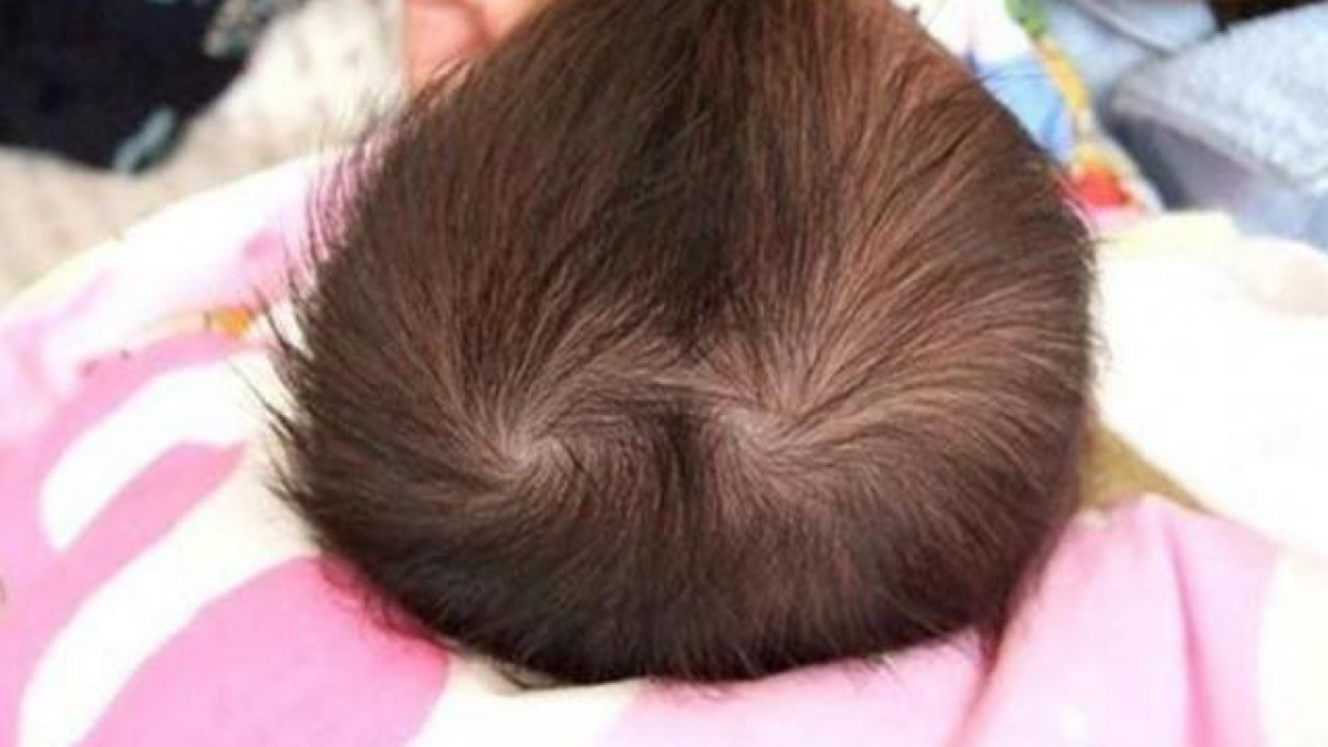 Nguyên nhân khiến tóc thưa? Biện pháp chữa tóc thưa hiệu quả