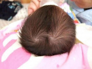Làm mẹ - Nhìn xoáy tóc biết vận mệnh, trẻ có 2 xoáy đầu thường nghịch ngợm, tài giỏi hơn người