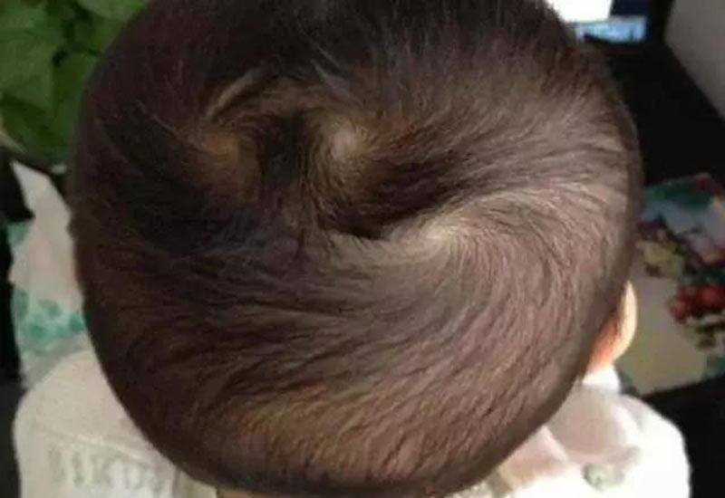 Nhìn xoáy tóc biết vận mệnh, trẻ có 2 xoáy đầu thường nghịch ngợm