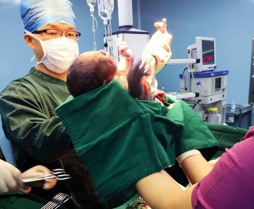 Em bé cười ngay khi chào đời ngay lập tức bị bác sĩ tát, mẹ cám ơn rối rít - 3