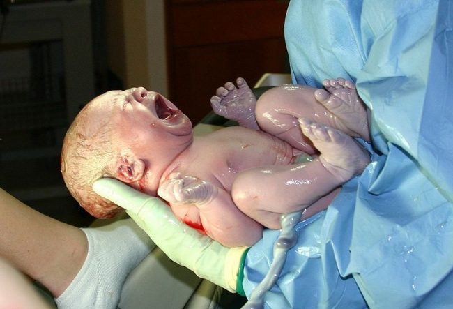 Em bé cười ngay khi chào đời ngay lập tức bị bác sĩ tát, mẹ cám ơn rối rít - 5