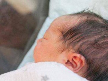 Từ vụ bé gái sinh nặng 4kg, chuyên gia khuyến cáo thai phụ cần thận trọng với dị tật này