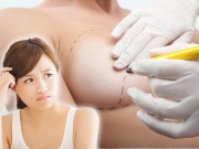 Làm đẹp - Giải đáp loạt thắc mắc về phương pháp bơm ngực, ai định nâng cấp vòng 1 chớ bỏ qua!