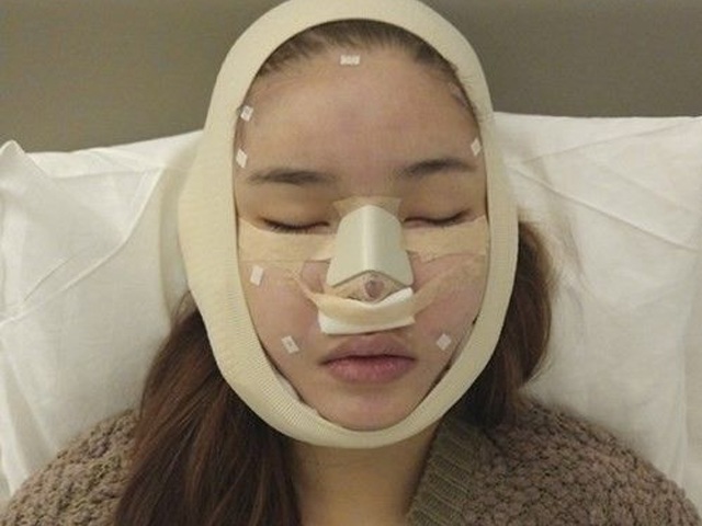 Những sao Việt gian nan vì đập đi sửa lại, kiên trì mãi mới tới đỉnh cao nhan sắc - 18