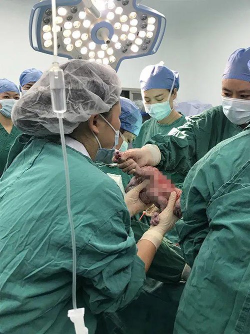 Thụ thai tự nhiên, vợ đẻ 1 lần 4 đứa trẻ, con vừa ra đời chồng liền “méo mặt” - 3