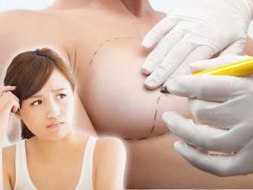Giải đáp loạt thắc mắc về phương pháp bơm ngực, ai định nâng cấp vòng 1 chớ bỏ qua!