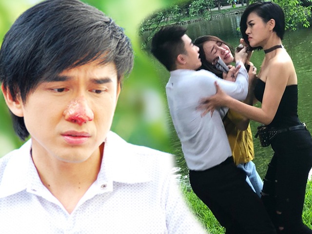 Hậu quả sau cảnh đánh ghen: Thu Quỳnh bị cỏ cào nát lưng, mũi Đan Trường sưng vù