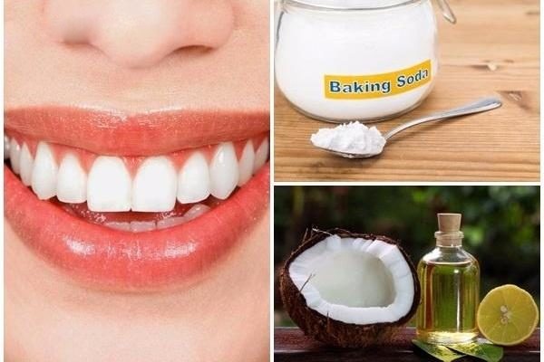 22 Cách làm trắng răng tự nhiên tại nhà hiệu quả nhanh nhất - 20
