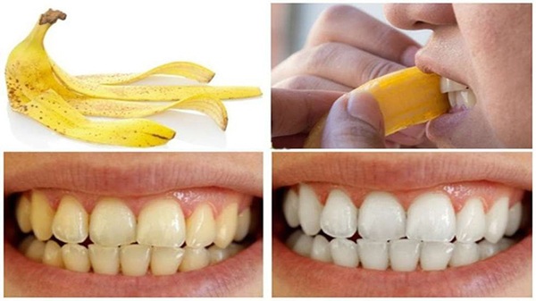 22 Cách làm trắng răng tự nhiên tại nhà hiệu quả nhanh nhất - 5