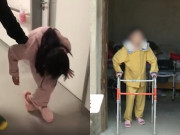 Tin tức - Cuộc sống hiện tại của cô gái bị gập đôi người, ngực áp vào đùi suốt hơn 10 năm