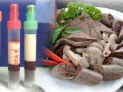 Sức khỏe - Những thực phẩm khiến máu trắng như sữa, càng ăn nhiều càng rước họa vào thân