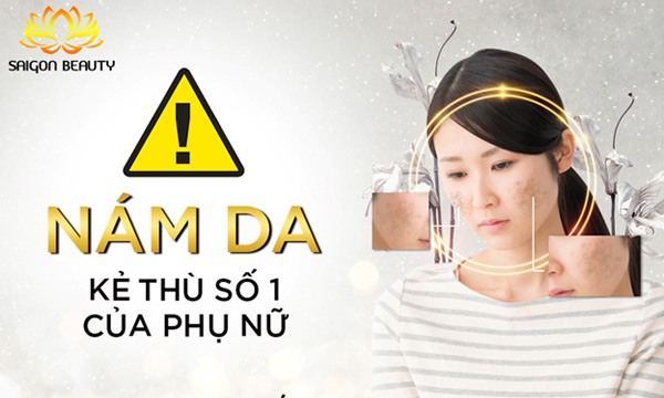 Trị nám, tàn nhang uy tín tại TMV SaiGon Beauty - 1