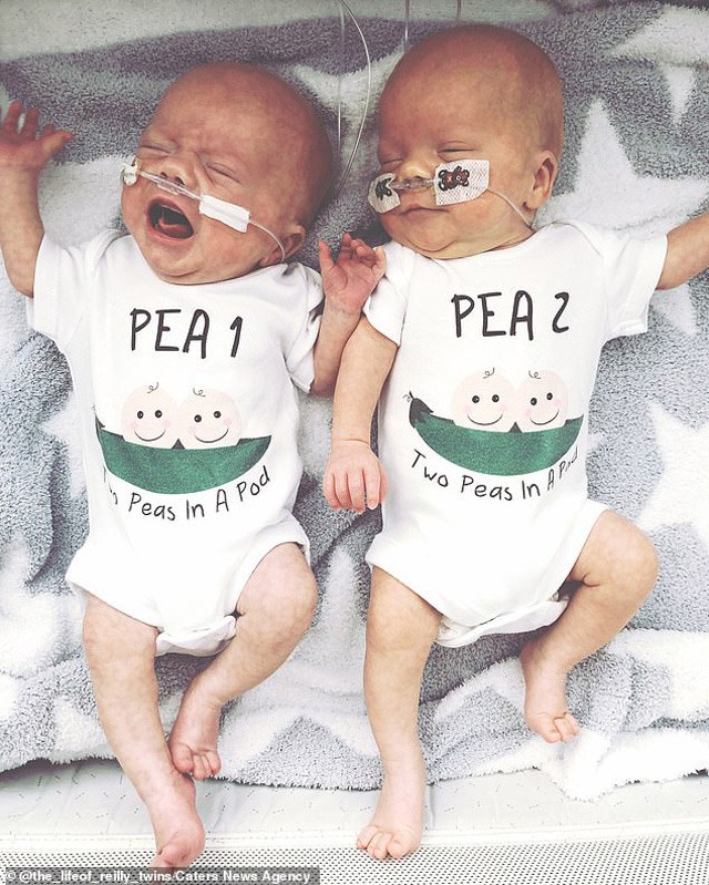 Sản phụ đang chuyển dạ thì hết đau, cặp sinh đôi chào đời cách nhau tận 2 ngày - 4