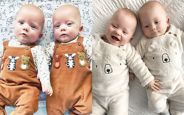 Sản phụ đang chuyển dạ thì hết đau, cặp sinh đôi chào đời cách nhau tận 2 ngày - 5