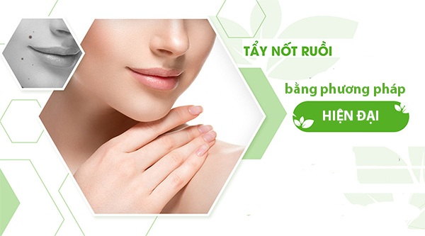 Tẩy nốt ruồi tại nhà và những lưu ý cần biết để tránh hậu quả khôn lường - 3