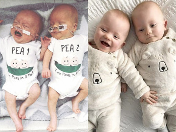 Sản phụ đang chuyển dạ thì hết đau, cặp sinh đôi chào đời cách nhau tận 2 ngày