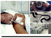 Tin tức - Gia cảnh nghèo khó của người đàn ông mang rắn độc đến bệnh viện sau khi bị cắn