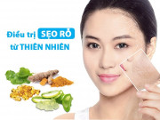 Làm đẹp - Không cần tốn tiền triệu vẫn tự tin lấp đầy sẹo rỗ với các nguyên liệu tự nhiên tại nhà