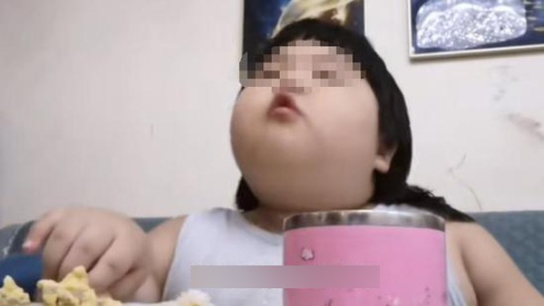 Bị bố mẹ vỗ béo để làm nhân vật kiếm tiền, bé gái 3 tuổi đã nặng 32 kg - 5