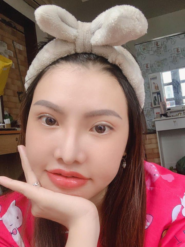 Hai hiện tượng mạng xã hội nổi tiếng với câu chuyện “dao kéo”: Liệu đâu là điểm dừng? - 8