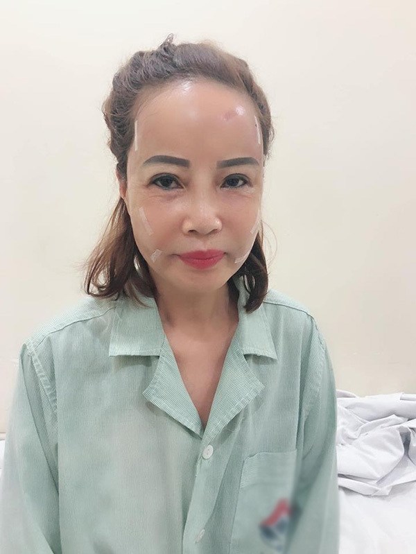 Hai hiện tượng mạng xã hội nổi tiếng với câu chuyện “dao kéo”: Liệu đâu là điểm dừng? - 2