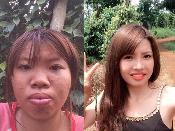 Hai hiện tượng mạng xã hội nổi tiếng với câu chuyện “dao kéo”: Liệu đâu là điểm dừng? - 10