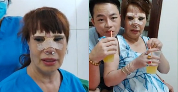 Hai hiện tượng mạng xã hội nổi tiếng với câu chuyện “dao kéo”: Liệu đâu là điểm dừng? - 5