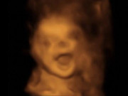 Bà bầu - Đi siêu âm, thai nhi khiến bố mẹ tan chảy bởi hành động lạ trong bụng