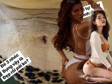 Chưa chắc hậu sinh nở mới rạn da, mỹ nhân khoe body nuột nà cũng có khuyết điểm này