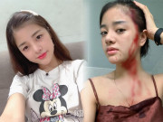 5 hot girl không ai ngờ lại lận đận tình duyên, bị bạn trai hoặc chồng cũ đánh đập