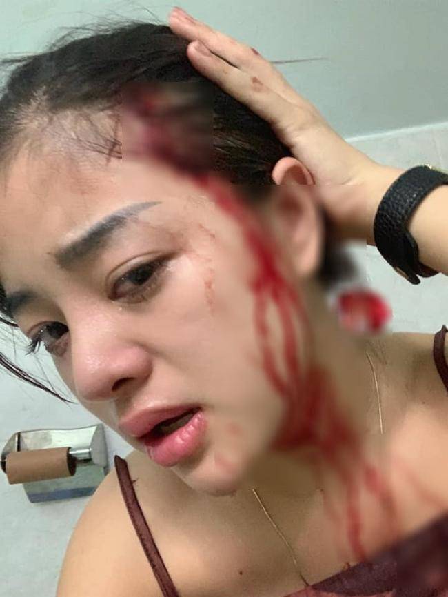 5 hot girl không ai ngờ lại lận đận tình duyên, bị bạn trai hoặc chồng cũ đánh đập - 10