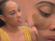 Sức khỏe - Người phụ nữ bị ghép da “vùng kín” lên mặt phải cầu cứu, sau phẫu thuật diện mạo ra sao?