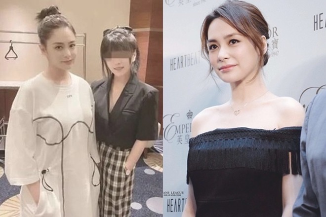 Chung Hân Đồng bị thương nhập viện gấp, công bố quá khứ gặp tai nạn khi ở với chồng cũ - 7